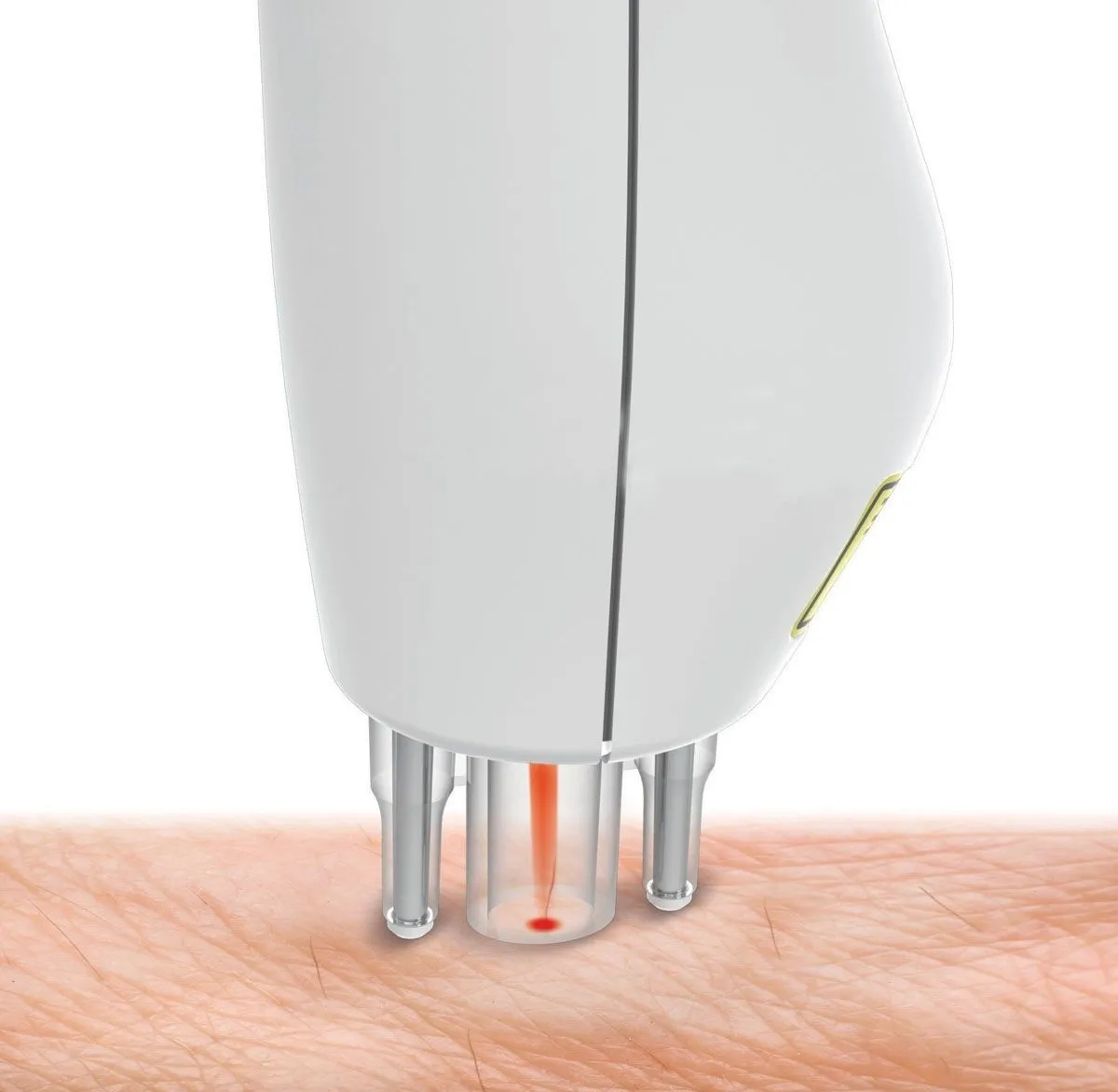 Эпилятор Rio Salon Chic в Москве и Московской области от магазина Ammina